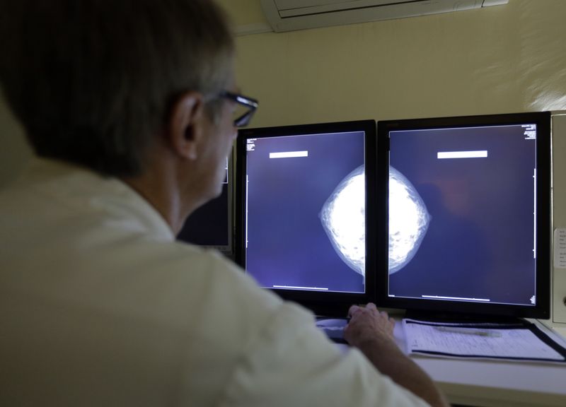 Health Trends: Genetic testing improves treatment, survival for Black breast cancer patients