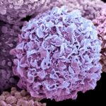 Breast cancer cells, SEM