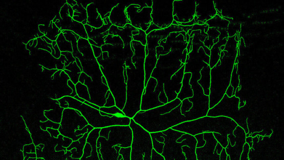 New genetic tool enables genome-wide analysis | Cornell Chronicle