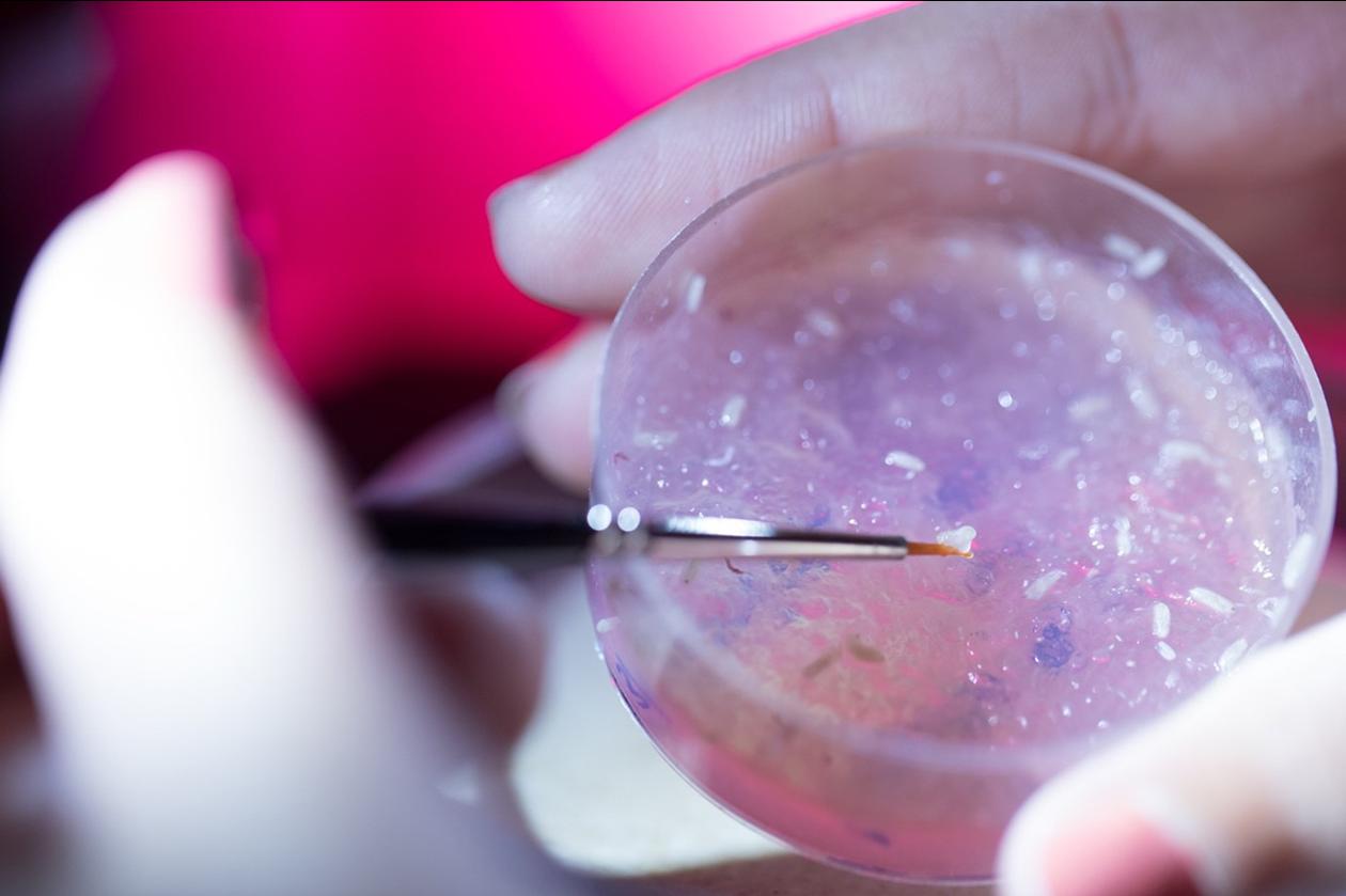 Photo: University of Malta ALS/MND Lab